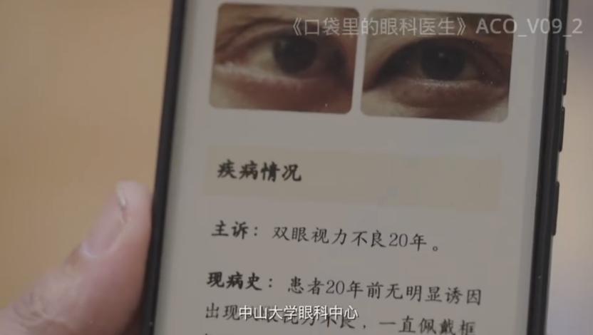 大规模筛查一周「看病」三千人,ai眼科大模型讲出了新故事
